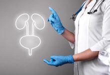 Urologia Goiânia - Conheça quais tumores podem afetar os órgãos genitais e urinários