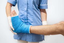 Clinica Ortopédica de Goiânia - Você sabe quais são as fraturas mais comuns e como preveni-las?