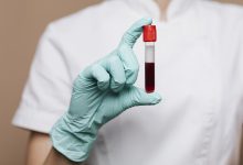 Jornal JA7 - Fiocruz desenvolve kit que detecta sangue infectado com malária