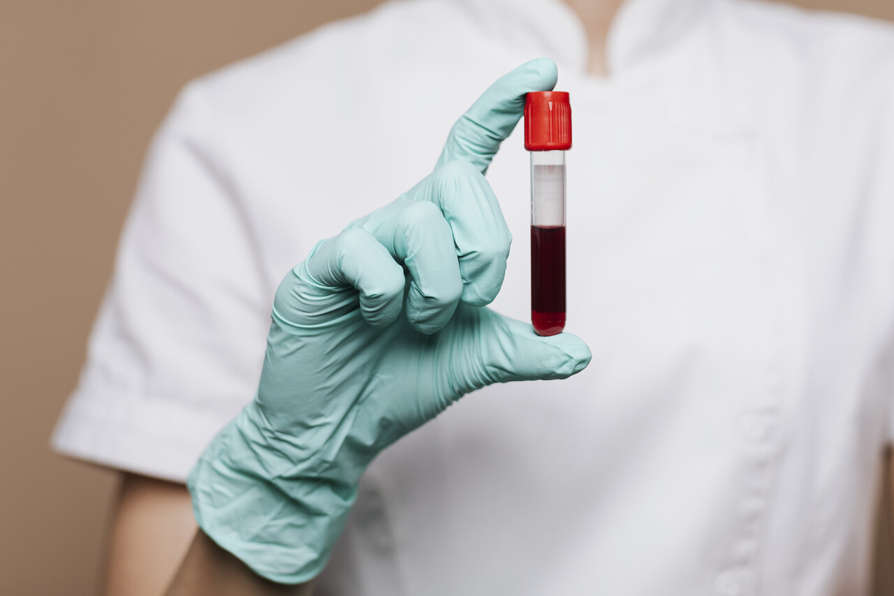 Jornal JA7 - Fiocruz desenvolve kit que detecta sangue infectado com malária