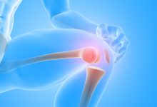 Ortopedia Goiânia - O que acontece no procedimento de artroscopia do joelho