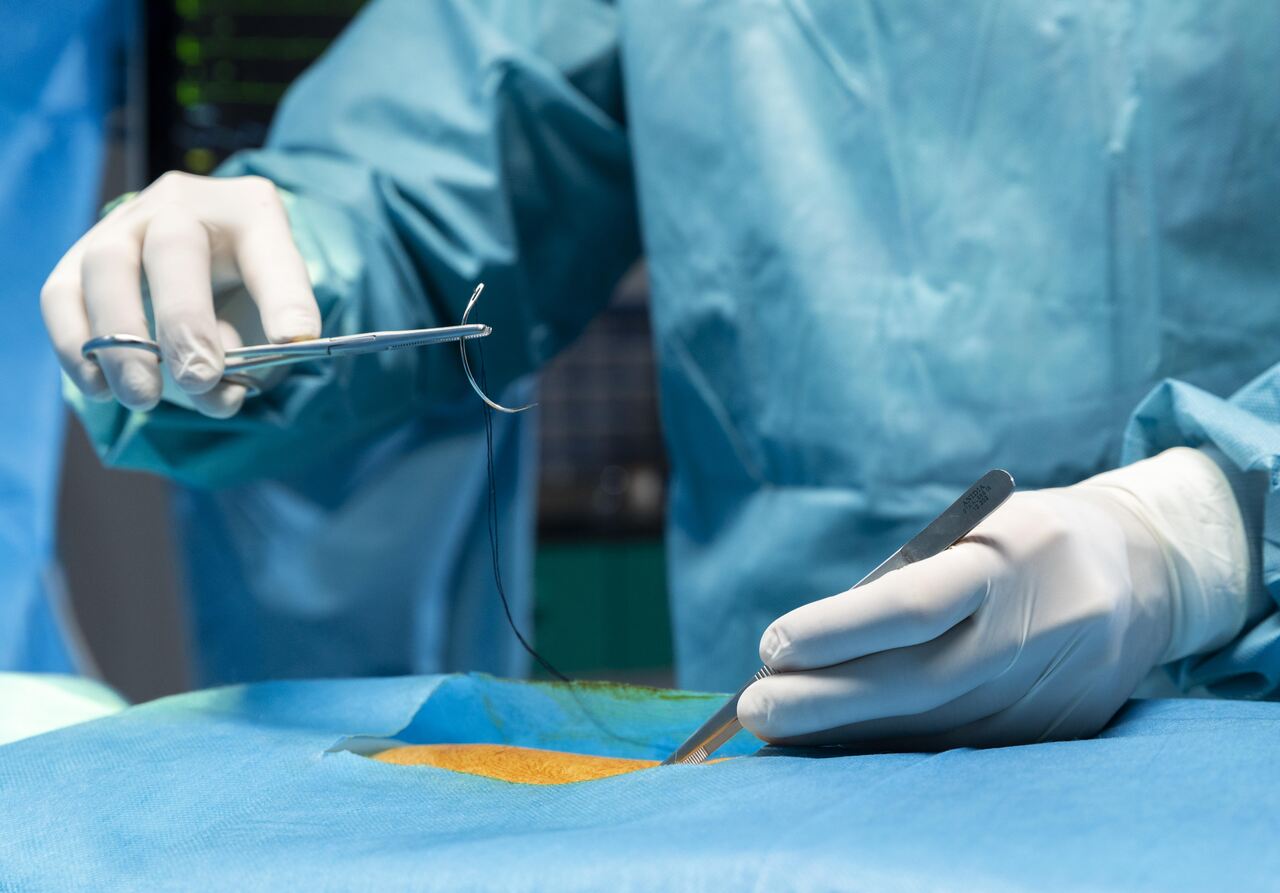 Jornal JA7 - Saúde Hospital público de Rondônia fará transplante de tecido ósseo