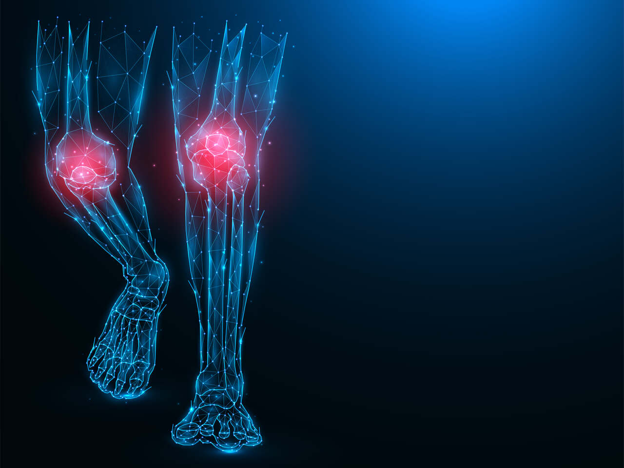 Ortopedia Goiânia - Conheça as 8 lesões mais comuns no joelho