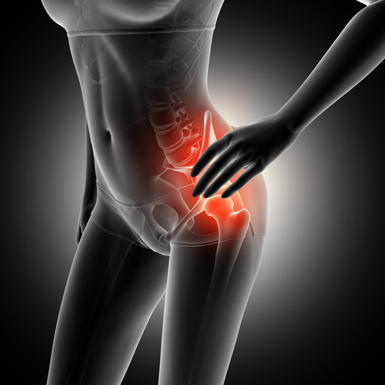 Ortopedia Goiânia - O que é impacto femoroacetabular