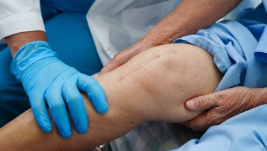 Ortopedia Goiânia - Como funciona a prótese de joelho?