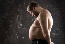 Nutrólogia Goiânia - Obesidade