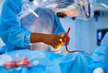 Cirurgia Plástica Goiânia - Qual a função do dreno na cirurgia plástica