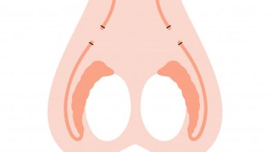 Urologia Goiânia - Mitos e verdades sobre a vasectomia