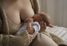 Cirurgia Plástica Goiânia - A mamoplastia redutora prejudica a amamentação?