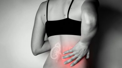 Urologia Goiânia - Mitos e verdade sobre pedra nos rins