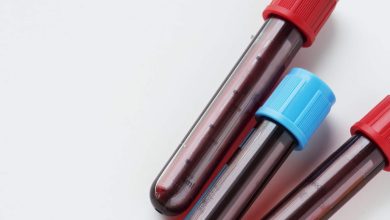 Novas regulamentações para licenciamento de irradiação de sangue e hemocomponentes são publicadas no Diário Oficial da União