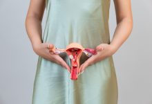 Mioma uterino: saiba quais são os sintomas e tratamentos