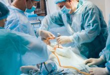 Vantagens da Prostatectomia Radical Laparoscópica no tratamento do câncer de próstata