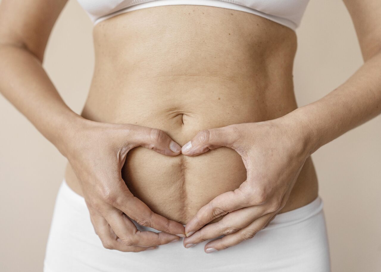 Quais tipos de cicatrizes são removidas com a cirurgia de correção de cicatrizes?
